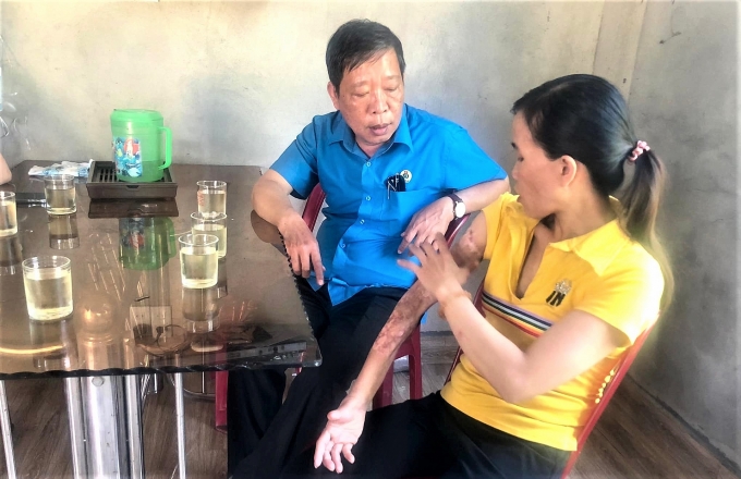 LĐLĐ tỉnh Thừa Thiên Huế chia sẻ khó khăn với gia đình đoàn viên bị tai nạn lao động LĐLĐ tỉnh Thừa Thiên Huế chia sẻ khó khăn với gia đình đoàn viên bị tai nạn lao động