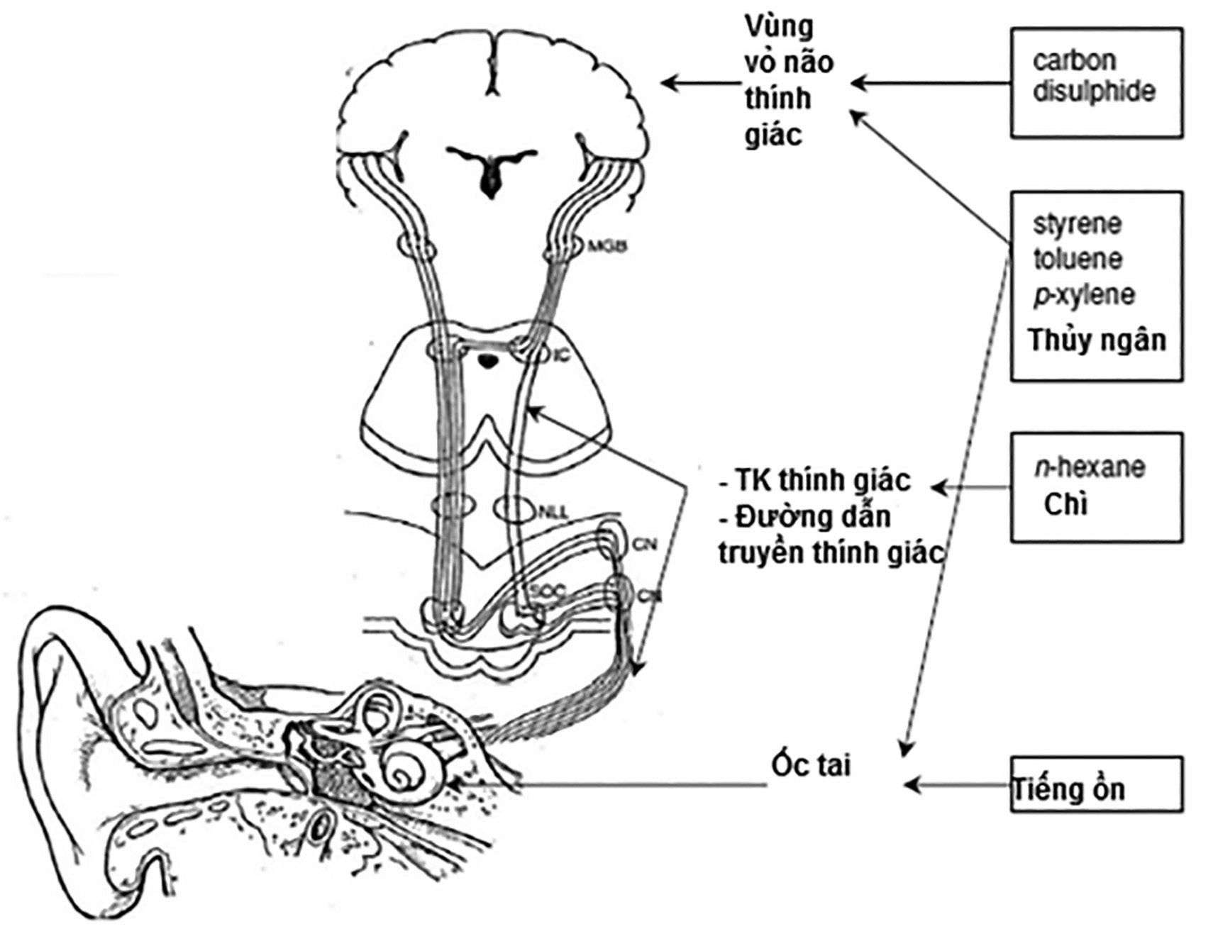 Quan tâm dự phòng bệnh giảm nghe nghề nghiệp