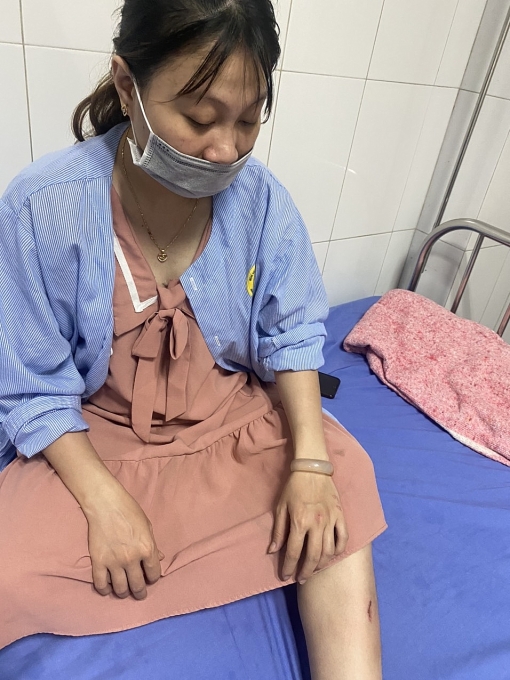 Công nhân Diệu chỉ bị xước xát nhẹ, không ảnh hưởng đến sức khỏe Công nhân Diệu chỉ bị xước xát nhẹ, không ảnh hưởng đến sức khỏe