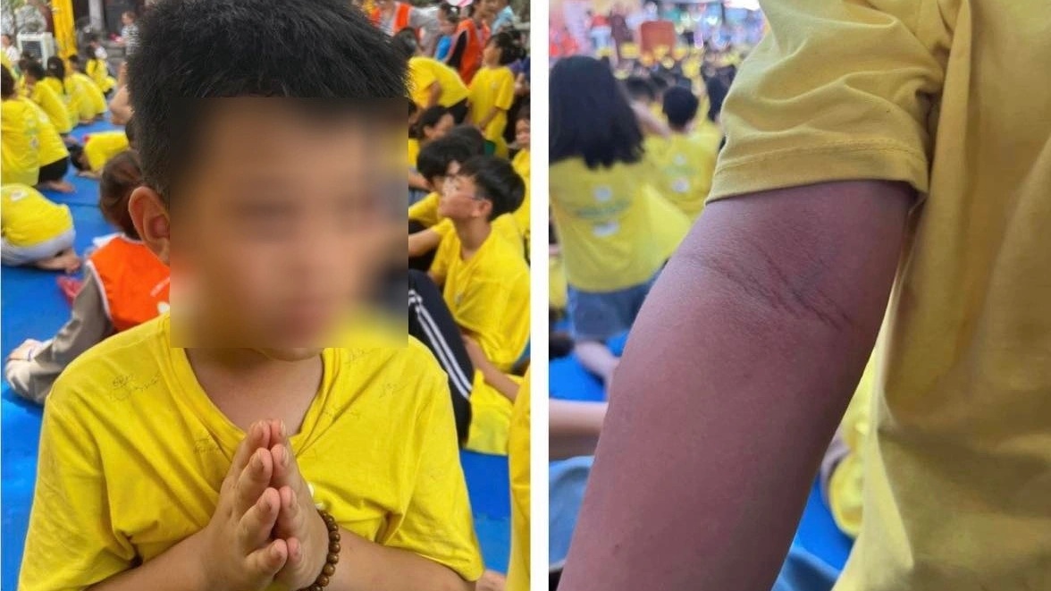 Khi trẻ thiếu sân chơi