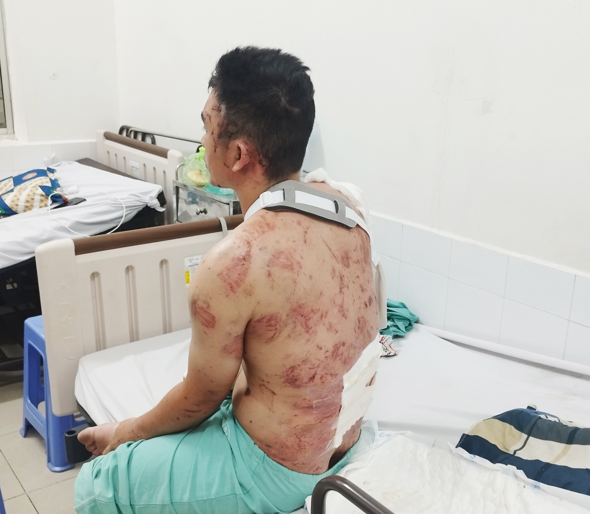 Nỗi đau gia đình nạn nhân vụ nổ lò hơi ở Đồng Nai