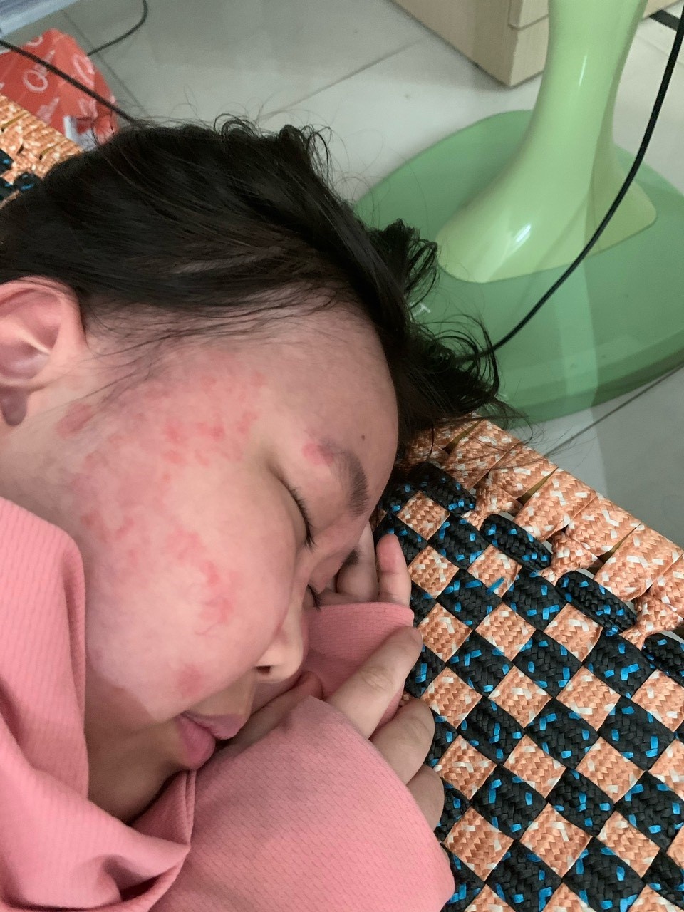 Công đoàn BIDV Phú Mỹ đồng hành với con gái nhân viên vượt qua bệnh tật Công đoàn BIDV Phú Mỹ đồng hành với con gái nhân viên vượt qua bệnh tật