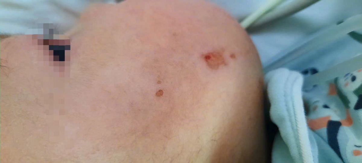 Vay 1,5 tỷ cứu con, gia đình giáo viên trẻ kiệt quệ Vay 1,5 tỷ cứu con, gia đình giáo viên trẻ kiệt quệ