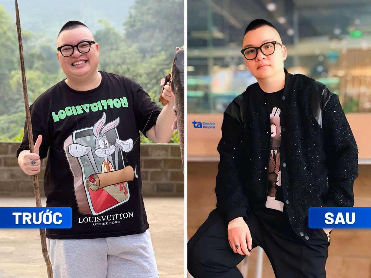 Hiệu quả ấn tượng của mô hình giảm cân an toàn, chuẩn y khoa quốc tế của Bệnh viện Tâm Anh