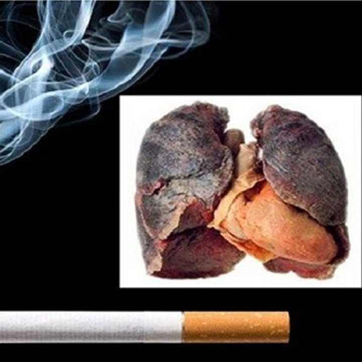 Không ai “miễn nhiễm” trước hiểm họa thuốc lá