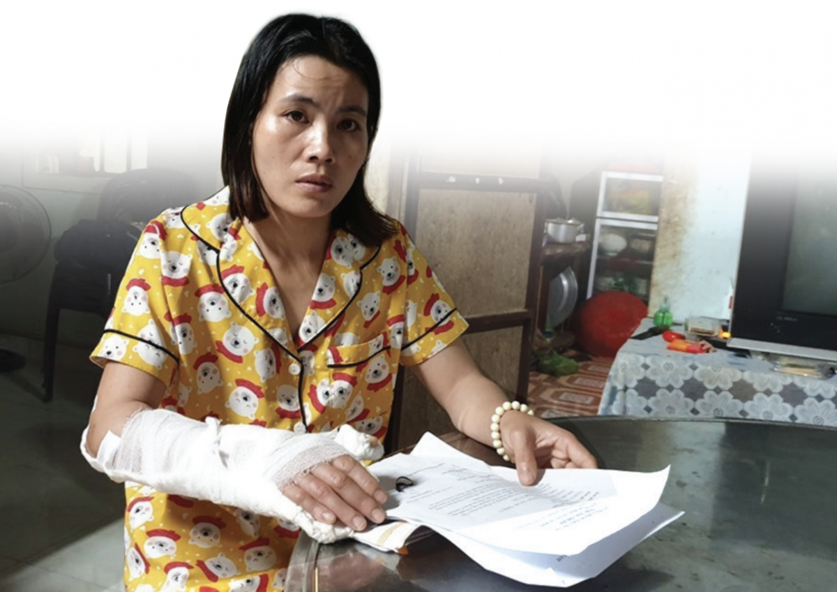 Chị Trần Thị Dung trải qua nhiều lần phẫu thuật ở Bệnh viện Trung ương Huế sau khi bị tai nạn lao động.