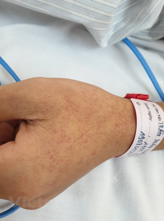 50 trường hợp tử vong vì dịch sốt xuất huyết trong năm 2019 50 truong hop tu vong vi dich sot xuat huyet trong nam 2019