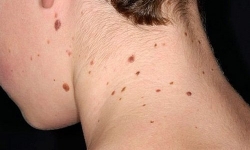 thoi quen om dien thoai may tinh dem ngay lam dang tang nguy co mac benh kho noi