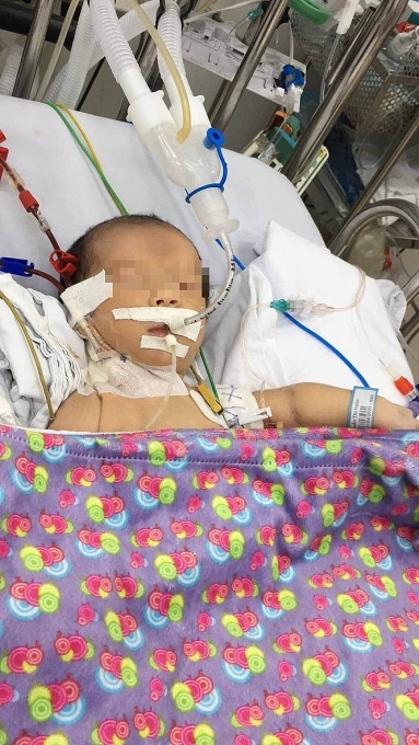 Bệnh viện Nhi Đồng 2 lọc máu cứu sống trẻ sơ sinh bị bệnh hiếm loc mau cuu song tre so sinh bi benh hiem