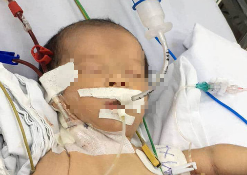 Bệnh viện Nhi Đồng 2 lọc máu cứu sống trẻ sơ sinh bị bệnh hiếm loc mau cuu song tre so sinh bi benh hiem