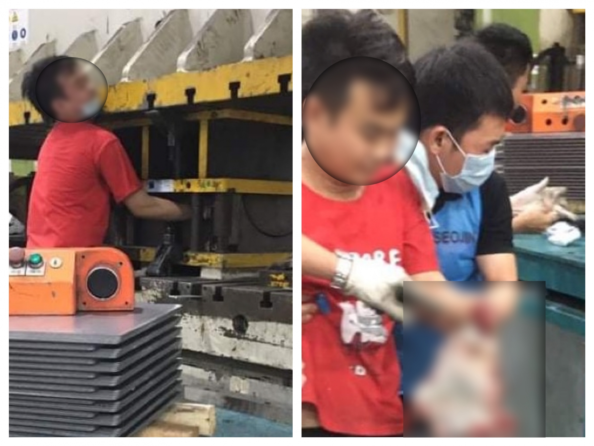 Tai nạn lao động: Nam công nhân bị dập nát hai cánh tay Tai nạn lao động: Nam công nhân bị dập nát hai cánh tay