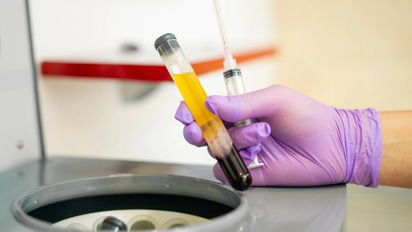 Những loại thuốc đang được sử dụng để điều trị Covid-19 và thông tin cần biết Những loại thuốc đang được sử dụng để điều trị Covid-19 và thông tin cần biết