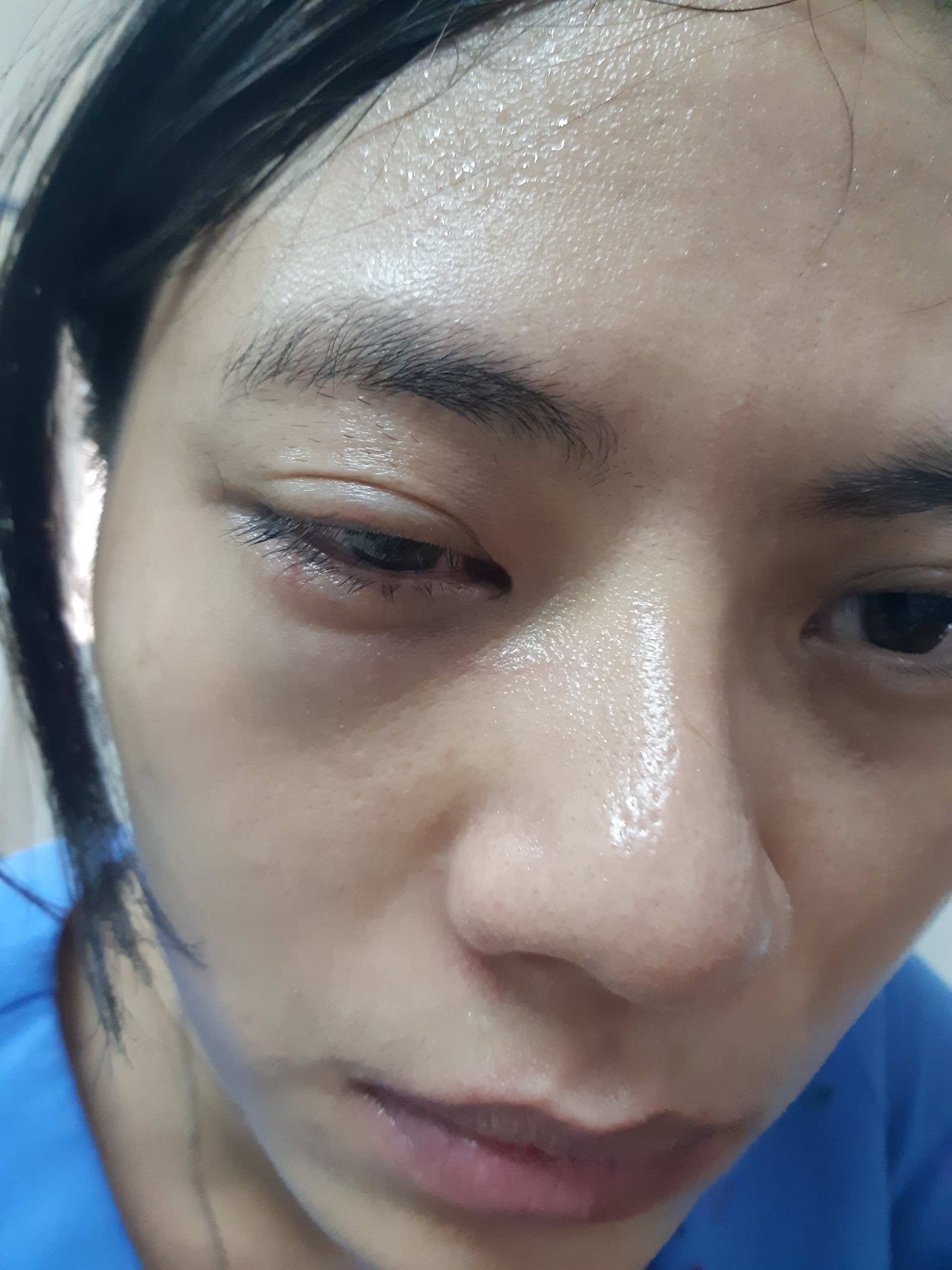 Vụ nữ điều dưỡng bị đánh dập nhãn cầu mắt: Đề nghị giải quyết vượt cấp công an phường Vụ nữ điều dưỡng bị đánh dập nhãn cầu mắt: Đề nghị giải quyết vượt cấp công an phường