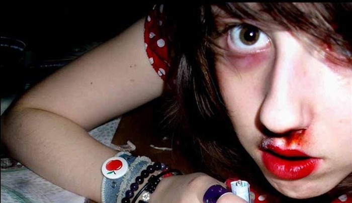 Kỳ 4: Những biểu hiệu nổi bật của người sử dụng chất ma túy ky 4 nhung bieu hieu noi bat cua nguoi su dung chat ma tuy