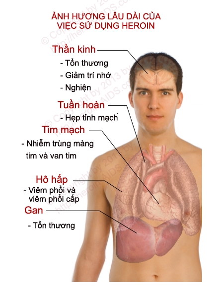 ky 6 nhung tac hai khung khiep cua viec nghien ma tuy