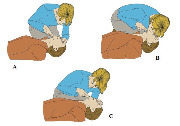 ky 12 cach xu ly khi gap truong hop ngo doc ma tuy