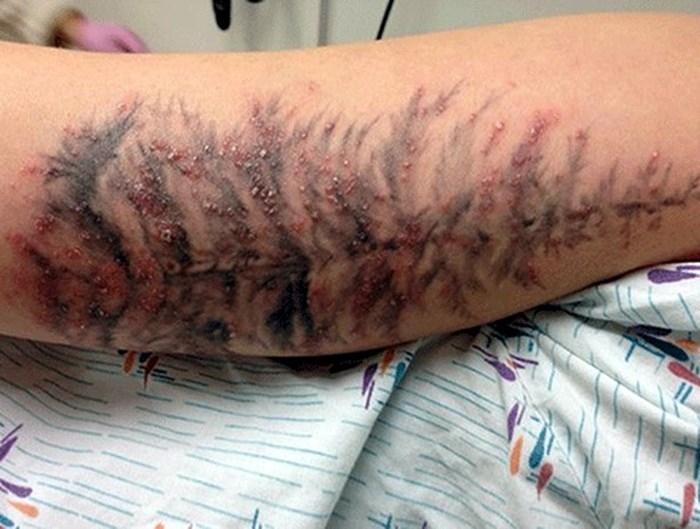 hinh xam nghe thuat ky 7 coi chung nguy co benh tat tu xam hinh khong an toan