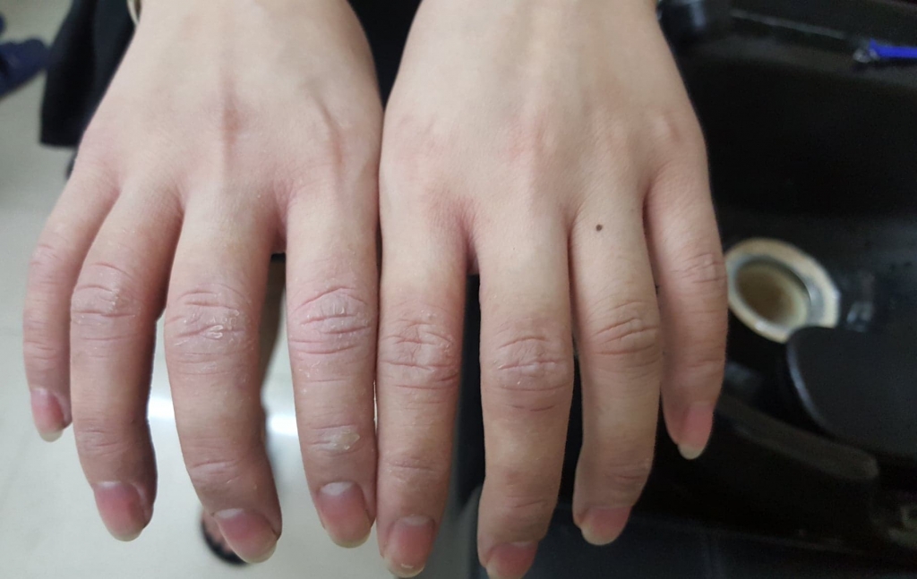 Thợ làm tóc đối mặt với những nguy cơ nhiễm bệnh gì? van de suc khoe nguy co nhiem benh voi tho lam toc