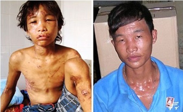 Từ thiện đúng cách - Bài 1: Khi lòng tốt cũng có thể gây tổn thương người khác Từ thiện đúng cách Bài 1: Khi lòng tốt cũng có thể gây tổn thương người khác