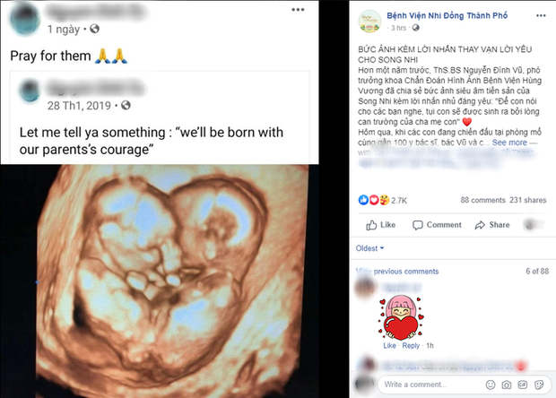 pho chu tich nuoc dang thi ngoc thi nh toi tham hai be song sinh truc nhi dieu nhi