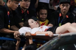 phao sang va goc toi