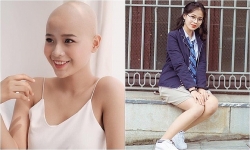 canh giac voi chieu tro huy dong von huong lai suat cao