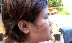 xom tro cong nhan bi dao chich dot nhap lay trom 2 xe may