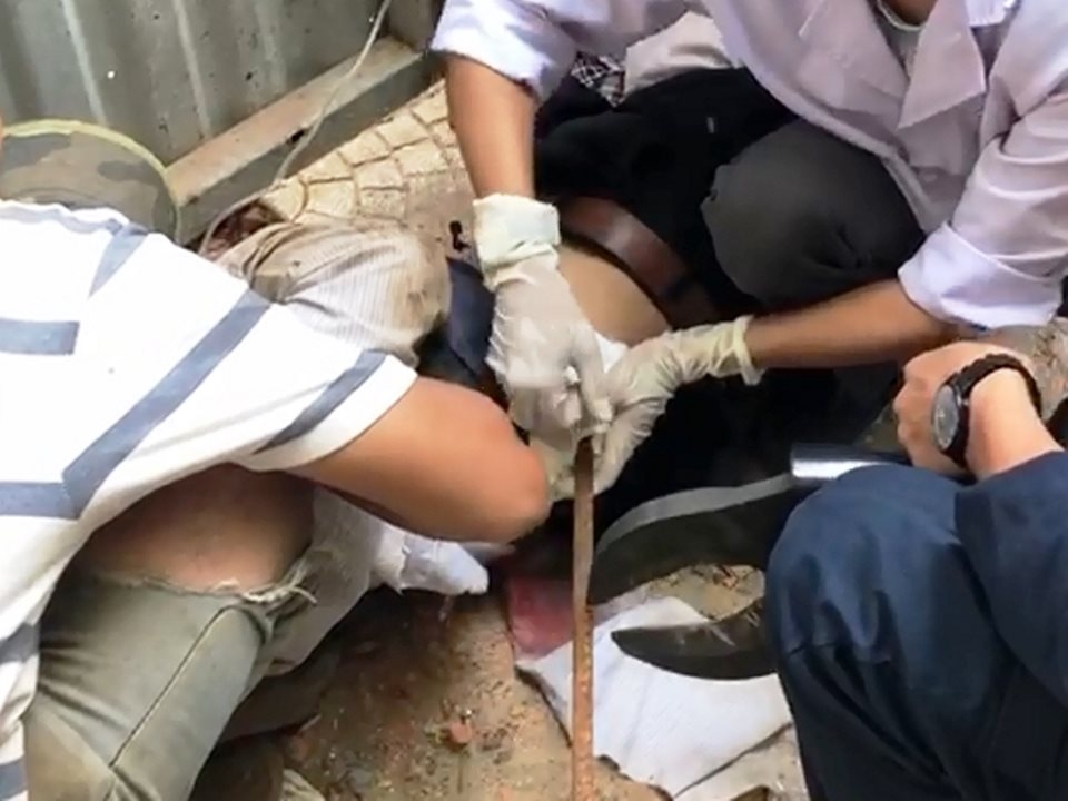 Nam công nhân nguy kịch vì bị thanh sắt dài 4m rơi trúng bụng