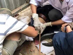 Nam công nhân nguy kịch vì bị thanh sắt dài 4m rơi trúng bụng