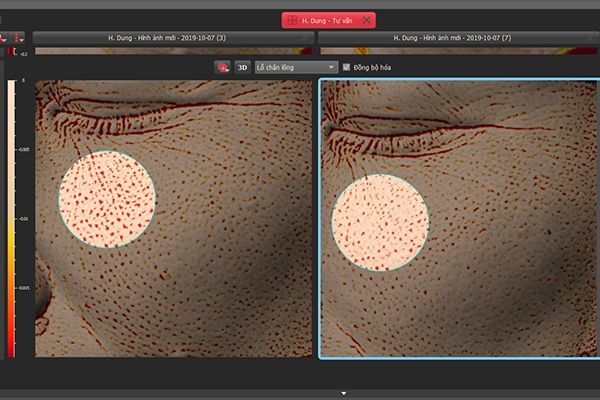Nhãn hàng Collagen Tây Thi New của Sao Thái Dương cam kết hoàn tiền 100% nhan hang collagen tay thi new cua sao thai duong cam ket hoan tien 100