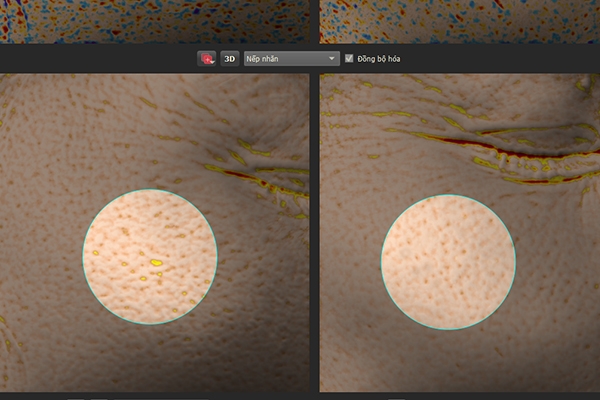 Nhãn hàng Collagen Tây Thi New của Sao Thái Dương cam kết hoàn tiền 100% nhan hang collagen tay thi new cua sao thai duong cam ket hoan tien 100