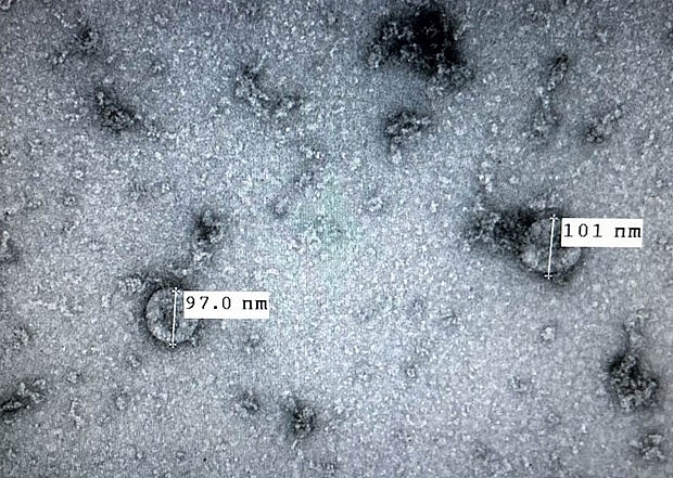 Các chủng cũ của virus corona có thể tồn tại ngoài vật chủ bao nhiêu ngày? cac chung cu cua virus corona co the ton tai ngoai vat chu bao nhieu ngay