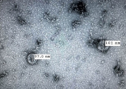 Các chủng cũ của virus corona có thể tồn tại ngoài vật chủ bao nhiêu ngày?