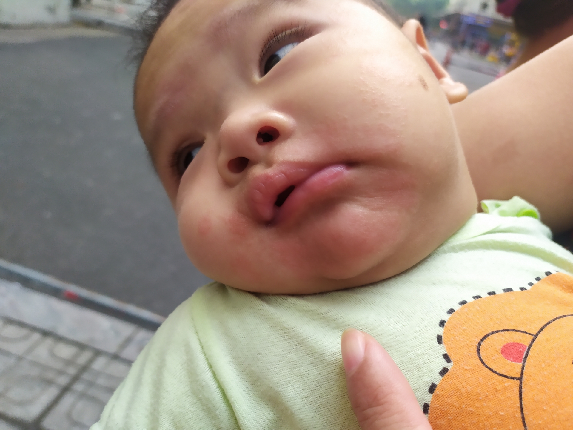 Vì sao nhiều người bị đau bụng tiêu chảy và mẩn ngứa ở khu chung cư HH Linh Đàm?