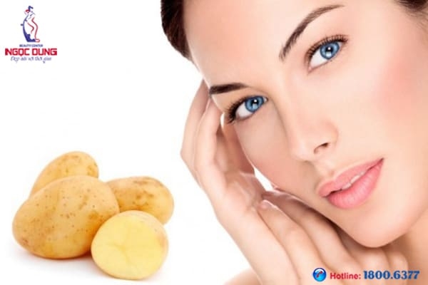 6 mẹo hay giúp phái đẹp giảm quầng thâm cho đôi mắt 6 meo hay giup phai dep giam quang tham cho doi mat