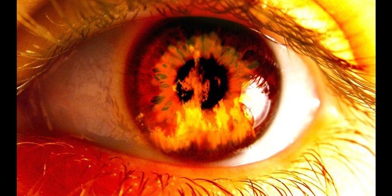 Bỏng mắt do tai nạn lao động và cách điều trị bong mat do tai nan lao dong va cach dieu tri