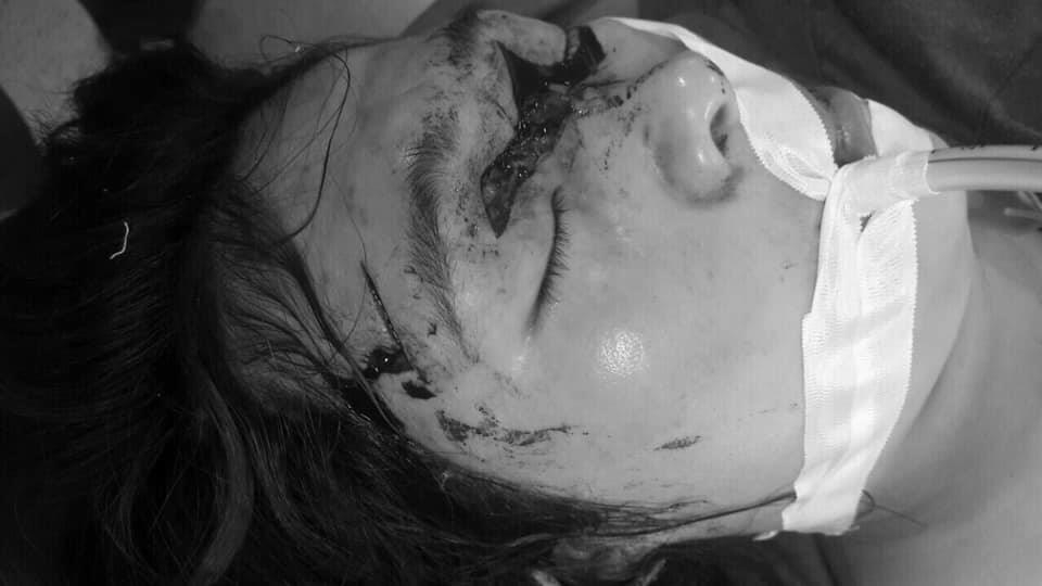 thai nguyen cho pitbull can hai me con khien be 4 tuoi dut khi quan me thung tran