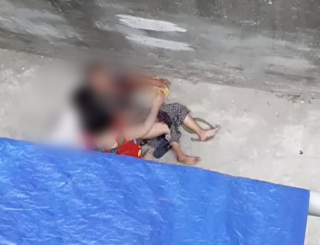 Từ vụ cụ bà bị tấn công, xử lý vết thương bị chó dữ cắn thế nào? tu vu cu ba bi tan cong xu ly vet thuong bi cho du can the nao