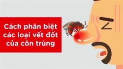 bi cho lai can be trai 7 tuoi phai khau gan 70 mui