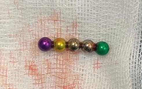 Cẩn trọng khi cho trẻ chơi với nam châm xếp hình can trong khi cho tre choi voi nam cham xep hinh