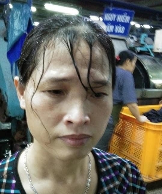 Nữ công nhân tố bị tổ trưởng hất xô hoá chất lên đầu Nữ công nhân tố bị tổ trưởng hất xô hoá chất lên đầu