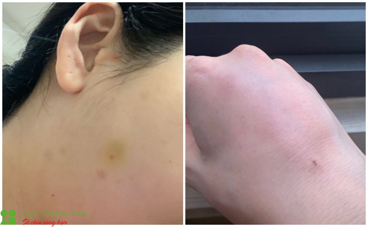 ky 2 cai goi la cong nghe tai sinh da tang