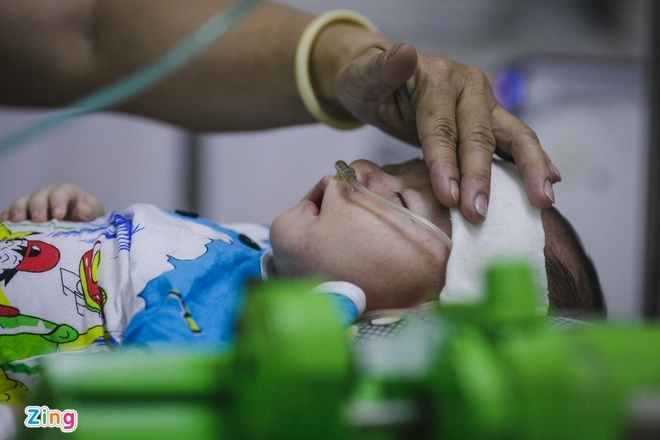 Bệnh tay chân miệng có nguy cơ bùng phát, Bộ Y tế có chỉ đạo khẩn benh tay chan mieng co nguy co bung phat bo y te co chi dao khan