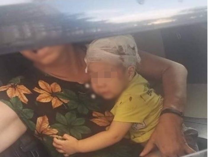 Chơi dưới sân chung cư, bé trai hơn 1 tuổi bị cây chổi rơi trúng đầu choi duoi san chung cu be trai hon 1 tuoi bi cay choi roi trung dau