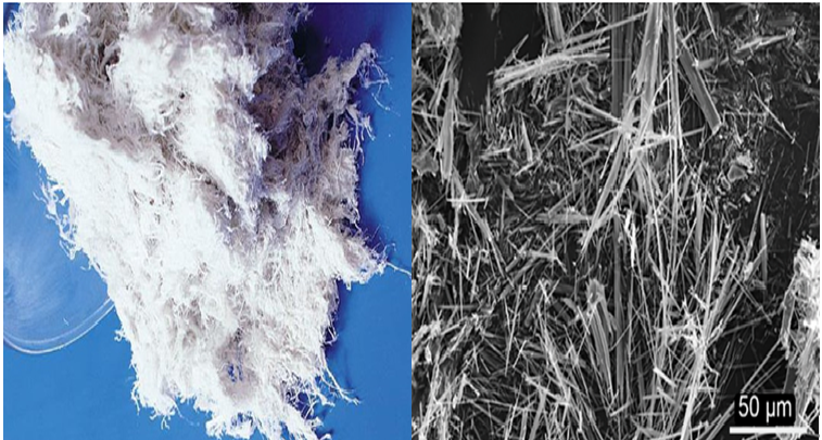 phan 1 amiang la nguyen nhan duy nhat dan toi benh u trung bieu mo