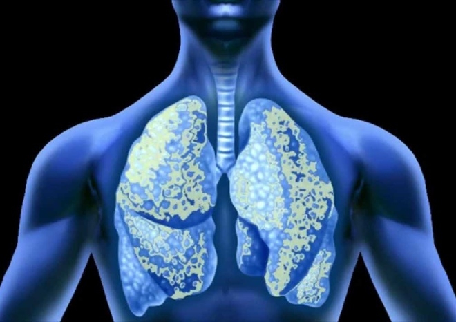 phan 3 co so phap ly cua viec dung san xuat amiang tai viet nam