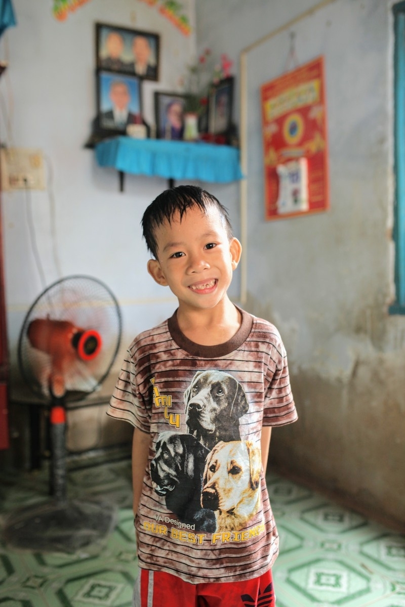 Những ca phẫu thuật tách rời các cặp song sinh thành công của Việt Nam nhung ca phau thuat tach roi cac cap song sinh ky luc cua viet nam