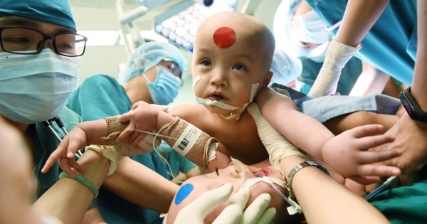Những ca phẫu thuật tách rời các cặp song sinh thành công của Việt Nam nhung ca phau thuat tach roi cac cap song sinh ky luc cua viet nam