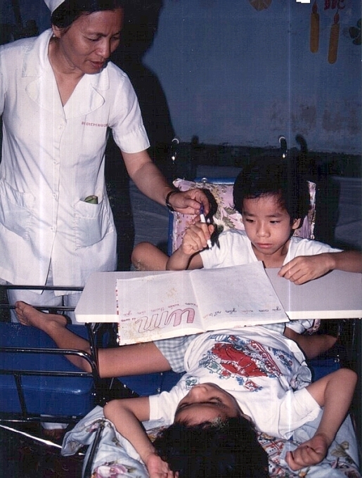 Những ca phẫu thuật tách rời các cặp song sinh thành công của Việt Nam nhung ca phau thuat tach roi cac cap song sinh ky luc cua viet nam