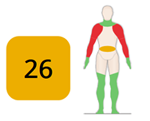 Rối loạn cơ xương khớp NN và  đánh giá tư thế lao động bằng công cụ HUMANTECH